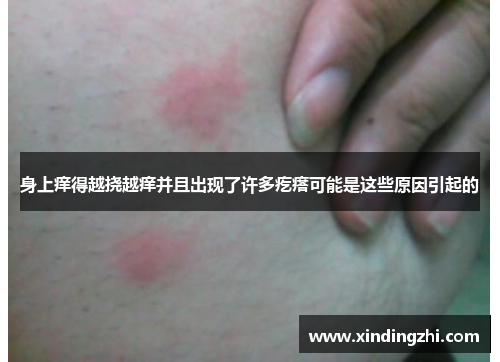 身上痒得越挠越痒并且出现了许多疙瘩可能是这些原因引起的